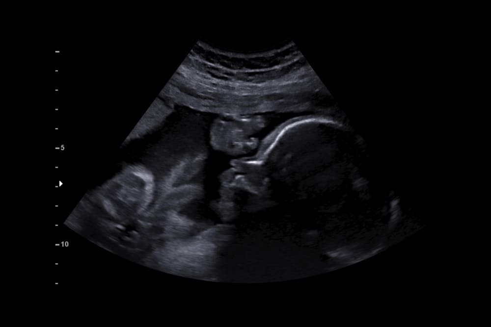 early gender ultrasound near me